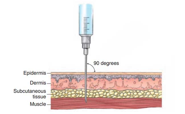 Picture showing the correct way to administer an IM injection