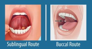 Sublabially Buccal and Sublingual Routes of Drug Administration: Advantages and ...