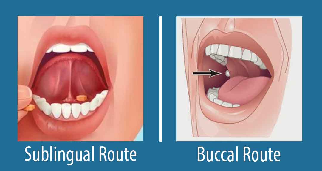 Featured image for Buccal and Sublingual Routes of Administration: Advantages and Disadvantages
