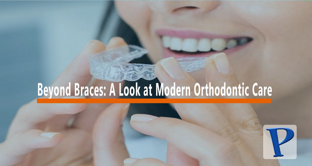 Featured image for Beyond Braces: A Look at Modern Orthodontic Care