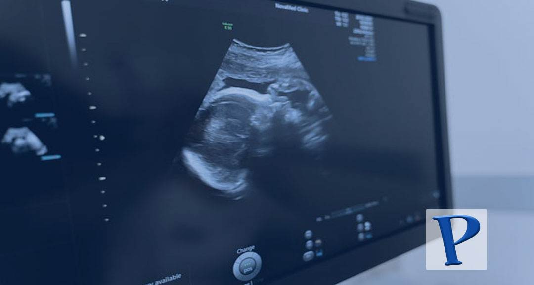 Featured image for: 8 Essential Tips for Ensuring a Healthy Pregnancy