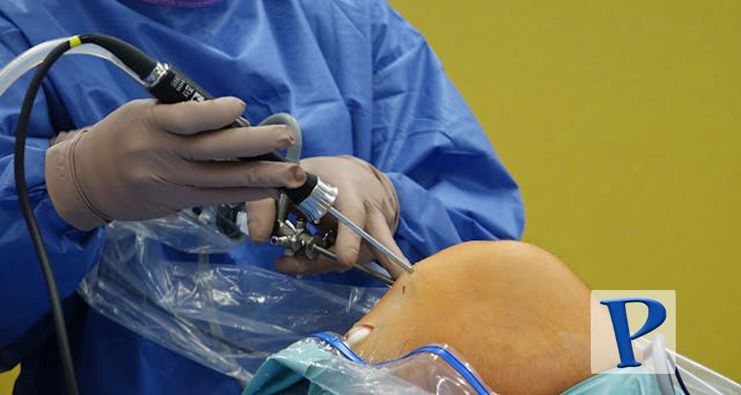Featured image for: What to Expect When Getting a Knee Replacement